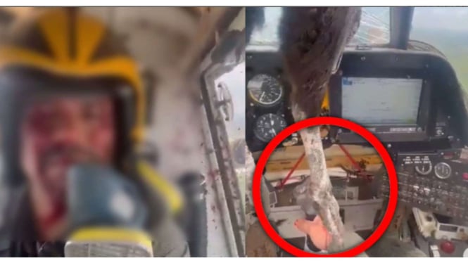 Viral Pilot Mendarat Dengan Muka Berdarah Gegera Ditabrak Burung Raksasa